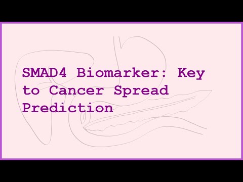 The SMAD4 Biomarker What Your Doctor Needs To Know About Cancer Spread 