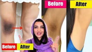 3-Day Challenge 100% Dark Body Part Even Private Areas Skin Lightening by Memoona Muslima