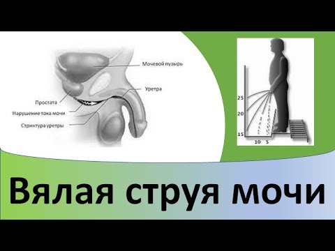 Видео: Почему мужчина не может мочиться?