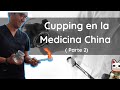Ventosas ( cupping) en la Medicina China: De la Teoría a la Investigación Moderna ( 2 parte)
