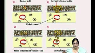 Mod-09 Lec-17 Autoimmuno-deficiencies f the B cells