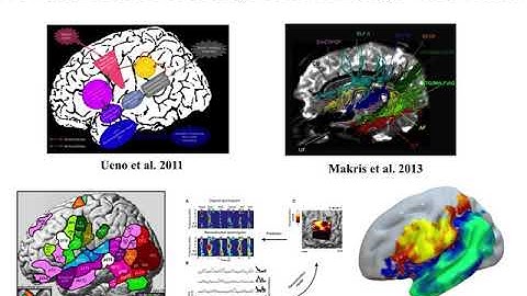 The Neural Architecture of Language: 5 decades of progress in 3 minutes
