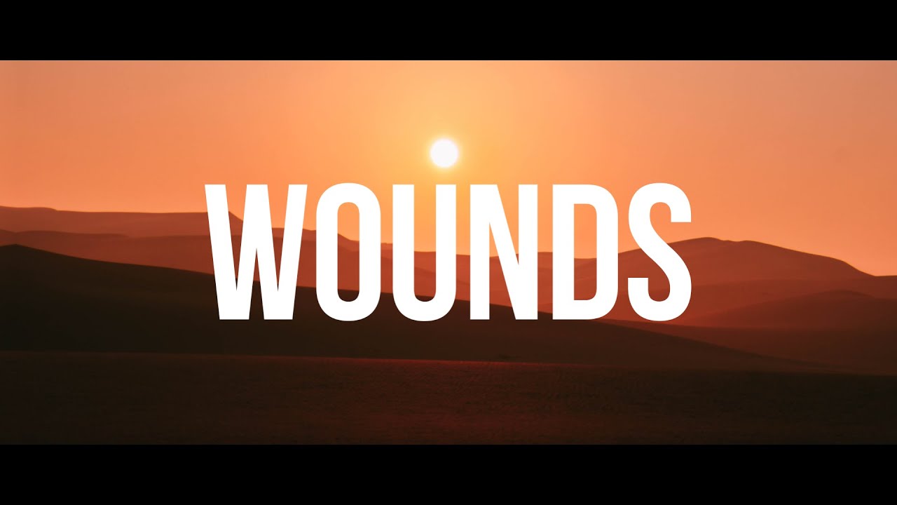 WOUNDS - JORDAN FELIZ //(Lyrics)//