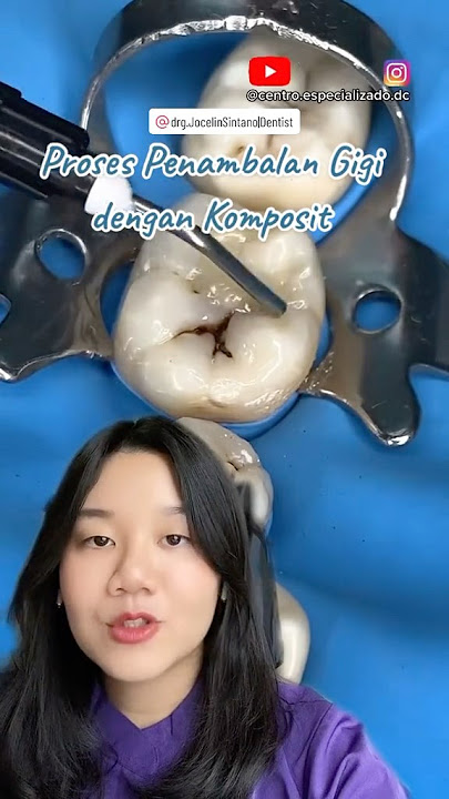 Proses TAMBAL GIGI Kaya Gimana? Yuk Simak yang Penasaran