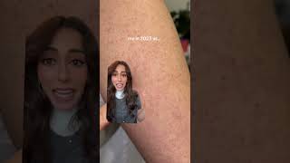 Simple Routine For Bumpy Skin Aka Keratosis Pilaris Dr Adel