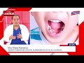 CARIES DE INFANCIA TEMPRANA - CLARA CISNEROS (ODONTOPEDIATRA HEVES)