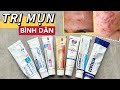 🔥Review🔥 TOP 7 THUỐC TRỊ MỤN BÌNH DÂN ĐÌNH ĐÁM NHẤT HIỆN NAY❗️