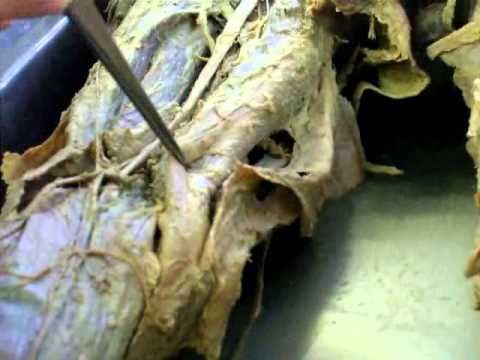 Анатомия a.femoralis (Бедренная артерия )