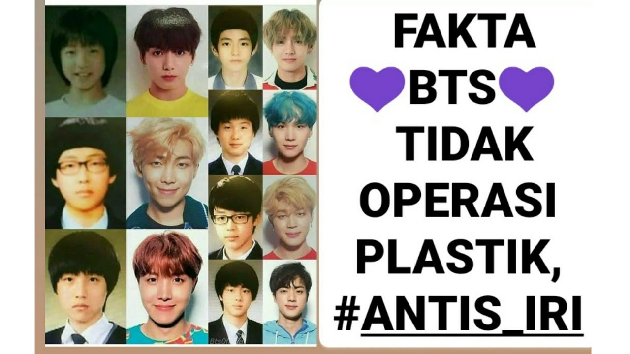 Bts sebelum operasi plastik