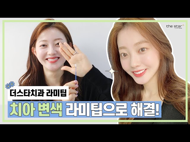 [더스타치과]미백으로 해결안되는 누런치아! 무삭제 라미팁으로🥰