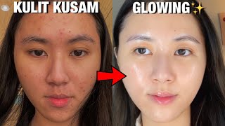 5 CARA AMPUH Untuk KULIT CERAH & GLOWING✨ || Dari Kusam jadi Glowing! 🌟