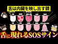 【健康チェック】舌からのSOSサインを見逃すべからず【ゆっくり解説】