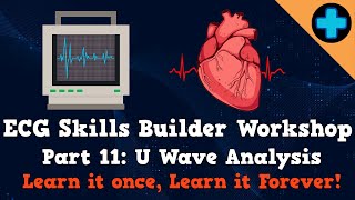 Electrocardiogram (ECG) Skills Builder Workshop Part 11: U Wave Analysis