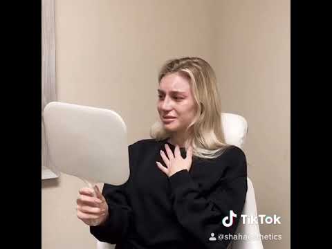 Video thumbnail: Brought To Tears - A Nose Reveal · Dr. Anil Shah