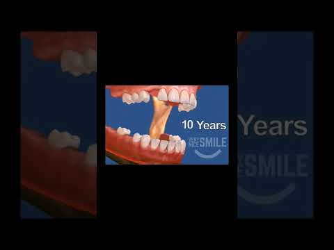 Video: Sunt buni dinții pentru adulți?
