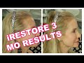 3 MONTHS IRESTORE RESULTS | BEFORE AND AFTER PICS  | LASER LIGHT THERAPY FOR HAIR LOSS IN WOMEN