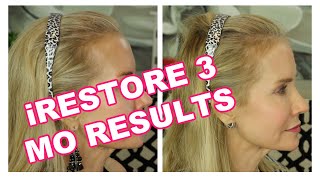 3 MONTHS IRESTORE RESULTS | BEFORE AND AFTER PICS  | LASER LIGHT THERAPY FOR HAIR LOSS IN WOMEN