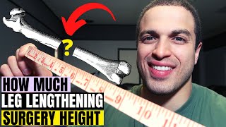 How much Limb Lengthening Height is safe to gain