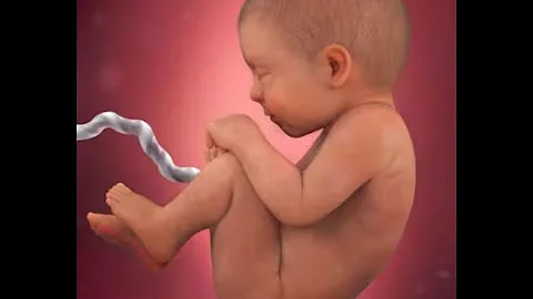 Pray for Scotland 6  -  Abortion -  The Facts