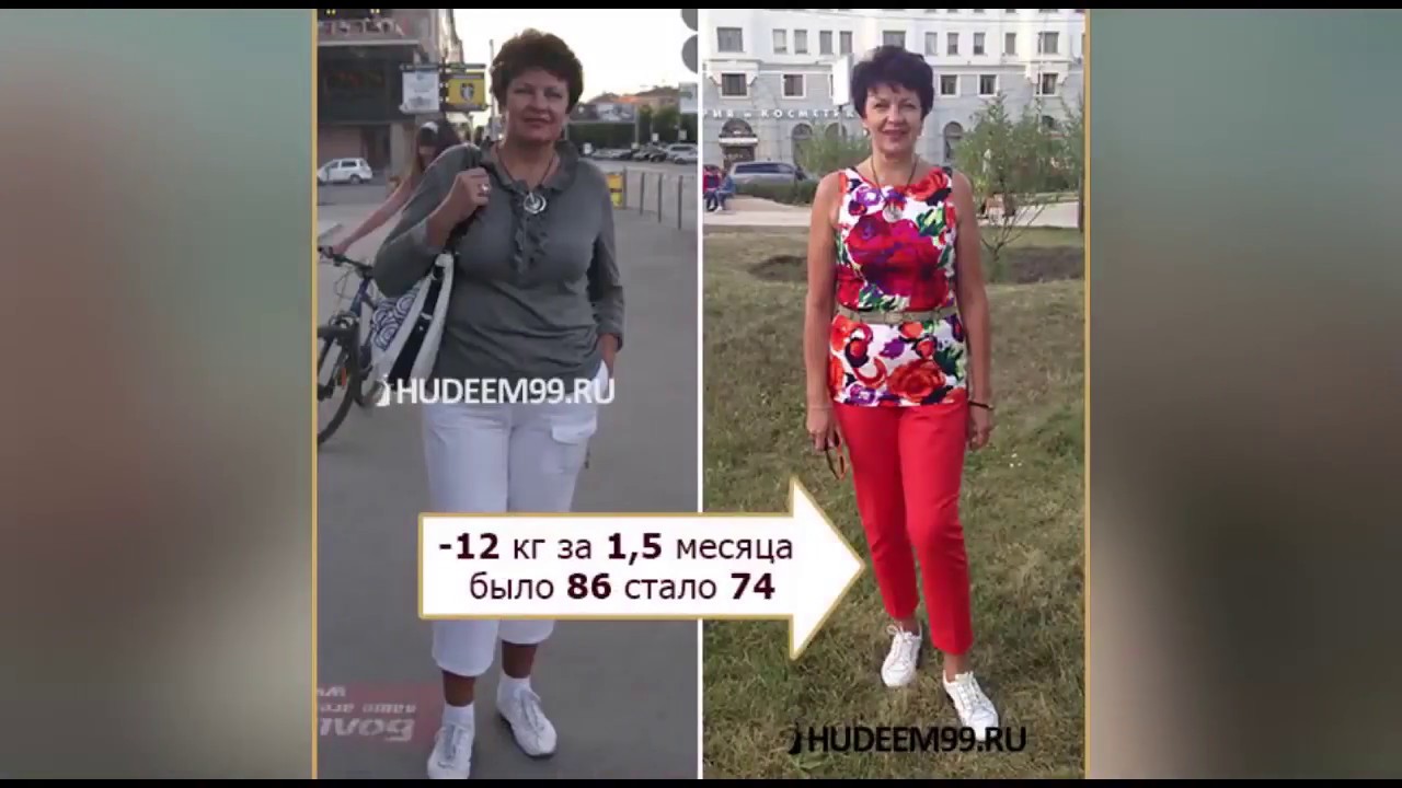 Обвисла кожа после похудения. Как ее подтянуть.