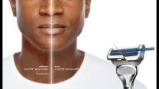 Gillette Skinguard Sensitive лезвия (сменные кассеты) Новинка