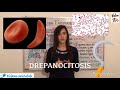 ANEMIA FALCIFORME - DREPANOCITOSIS - HbS💉 ¿rasgo drepanocítico? ¿Protección contra la malaria?👀🔝