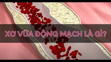 Xơ vữa động mạch là gì | Alo bác sĩ Chuyên trang Tạp chí Sức khoẻ Cộng đồng