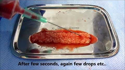 i PRF protocol video English