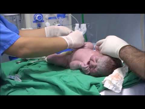 Vídeo: Primeiro Contato Com Um Bebê Recém-nascido
