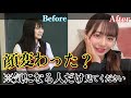 【全てお話しします】私の顔の変化について。【歯列矯正】【裏側矯正】