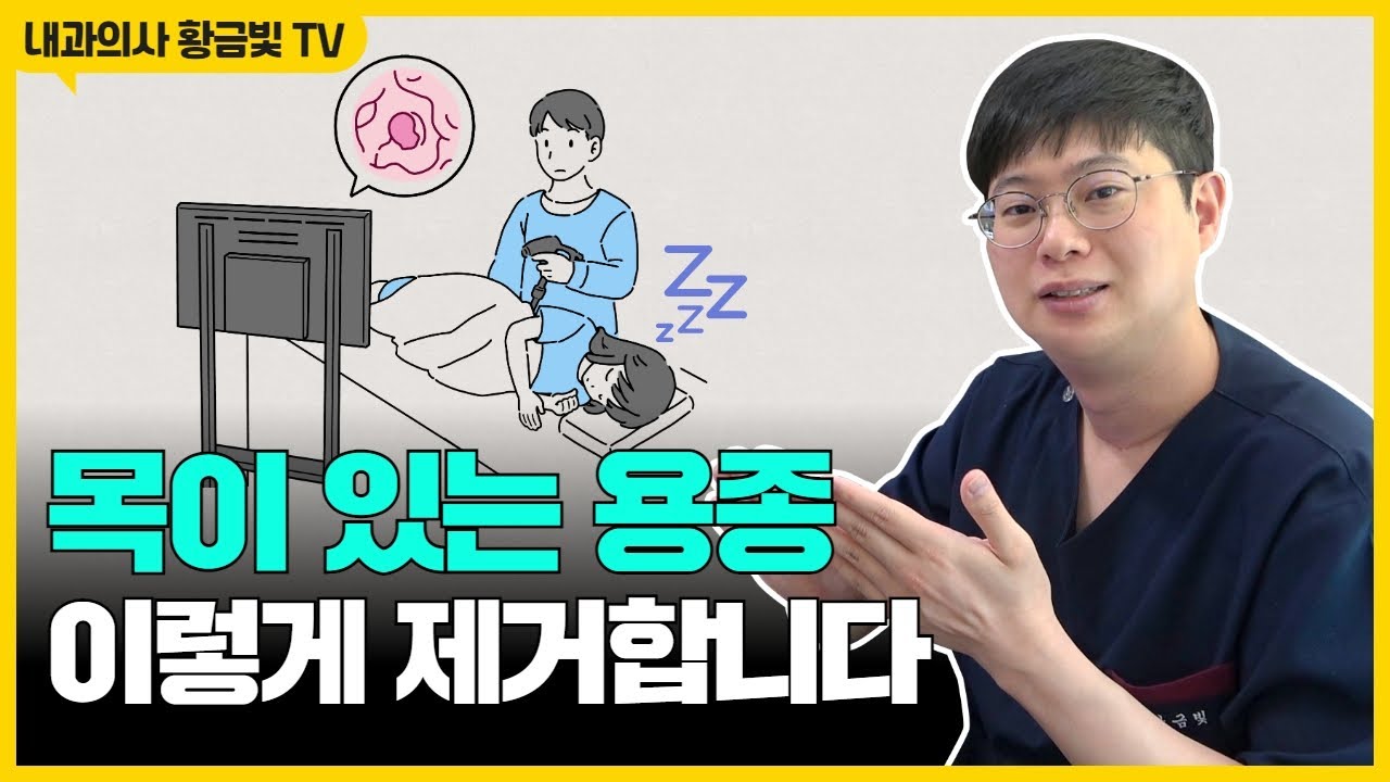 대장내시경 용종 이렇게 제거합니다 - YouTube