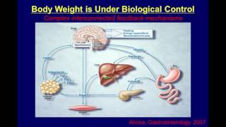 David Ludwig, MD, PhD -- Which Comes First: Overeating or Obesity