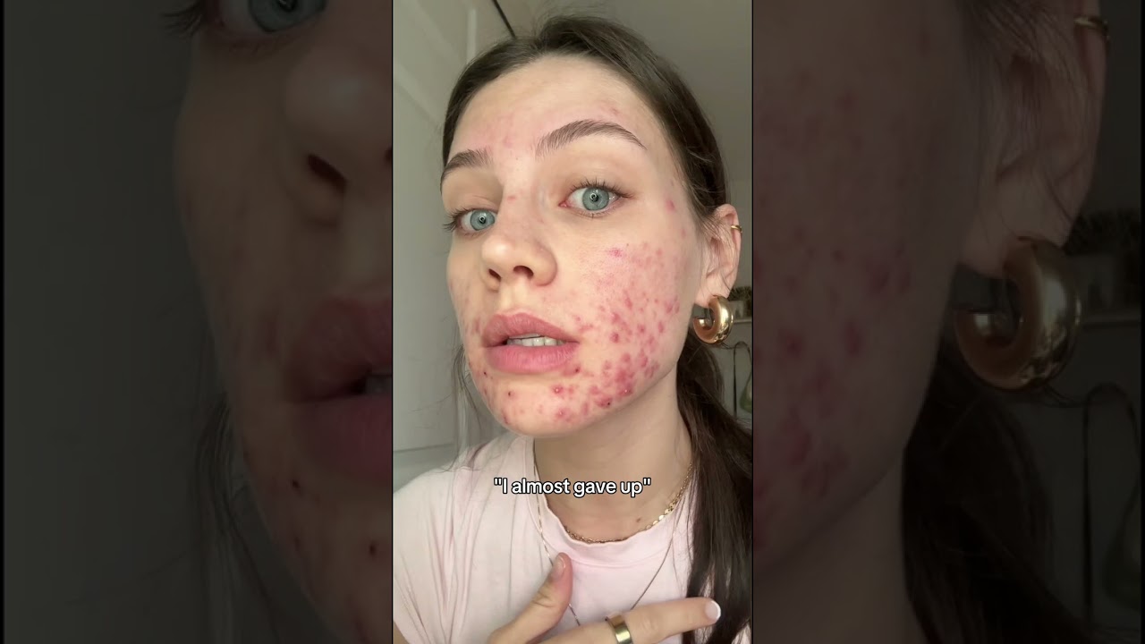 What about now? Glow with Luminence Beef Tallow Balm 