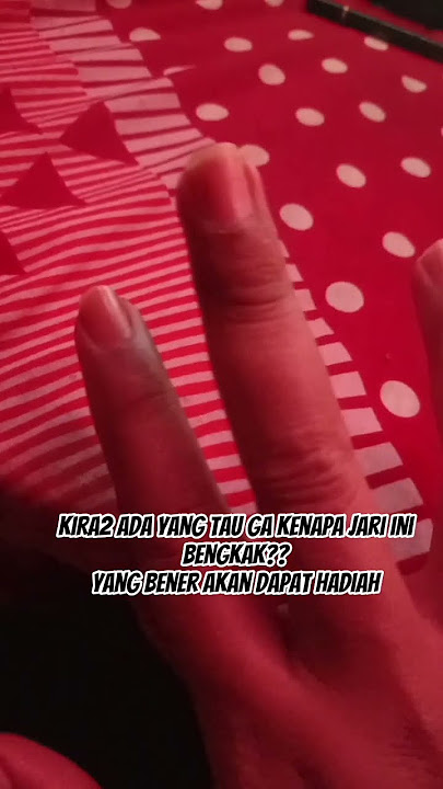 kira2 ada yang tau ga kenapa jari ini bengkak?? yang bener akan dapat hadiah #shorts #shortvideo