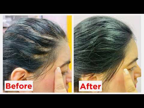 #AD Get rid of hair loss at home with L'Oreal Paris Fall Resist Serum | JSuper Kaur