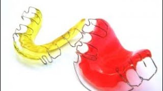 Introduction of Removable Appliance & Comparison with Fix Appliance