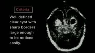 Findings in Fetal Sonography