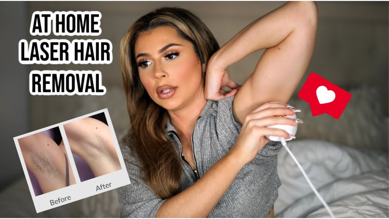 I tried at home laser hair removal and this happened 