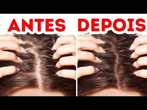 Vídeo: 14 Melhores Benefícios Do Pó De Gengibre (mês) Para Pele, Cabelo E Saúde