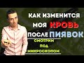 Как ставить пиявки в домашних условиях!? Как меняется кровь после пиявок? Польза «Гирудотерапии»