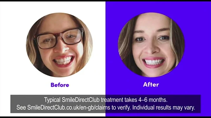 E4 - Continuity and Adverts - 1st August 2021