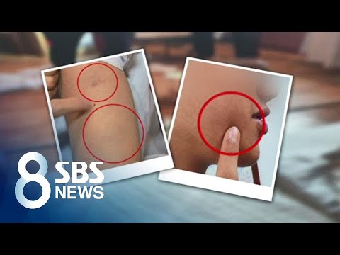 &amp;quot;왜 신고해&amp;quot; 모텔 불려간 피해 학생…<strong>유리병으로</strong> 맞았다 / SBS