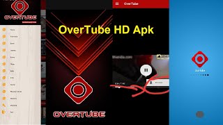 Baru.. OverTube Apk Video screenshot 1