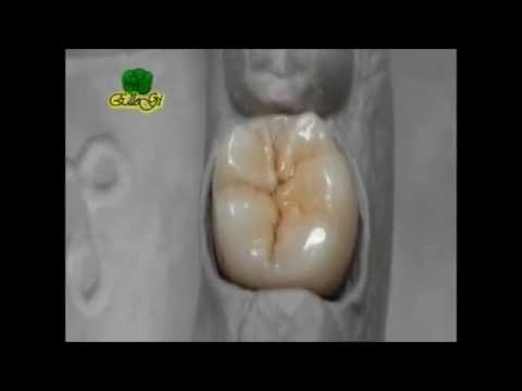 Video: Gocce Dentali: Istruzioni, Applicazione, Appuntamento