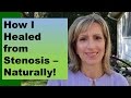 HOW I HEALED FROM STENOSIS - NATURALLY!