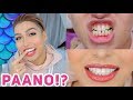 PAANO PUMUTI AT NAGPANTAY ANG NGIPIN KO!? MY VENEERS EXPERIENCE