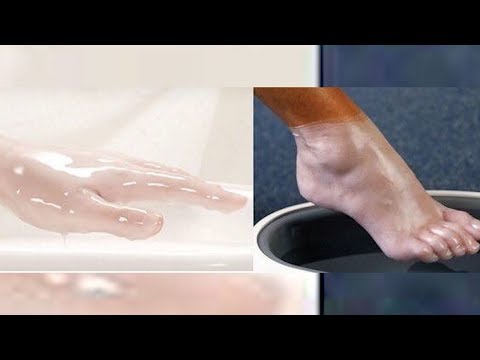 დაამარცხე ცელულიტი პარაფინის პროცედურებით