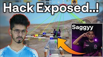 Saumraj exposed Saggy Hacking BGMI ! | BGMI New Type of Hack in iPhone device