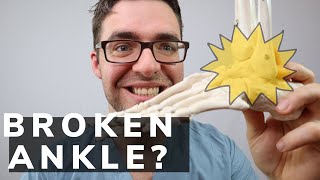 Broken Ankle Recovery Time [Ankle & Fibula Fracture Tips]