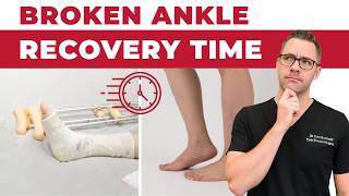 Broken Ankle Recovery Time Ankle & Fibula Fracture Tips